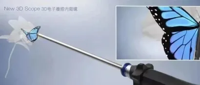 内窥镜技术迈入创新优化期，未来突破点路在何方？