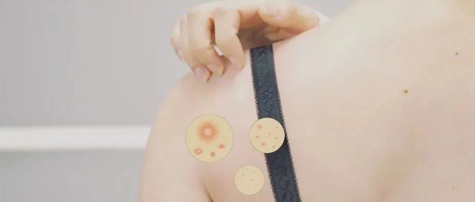 市场洞察 | 告别“遭罪”，女性内衣是怎么进化的？